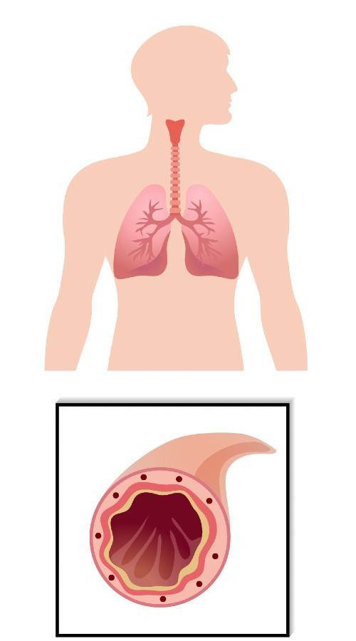 哮喘-正常支氣管